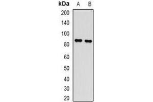Western blot analysis of L3MBTL3 expression in Hela (A), mouse spleen (B) whole cell lysates. (L3MBTL3 抗体)