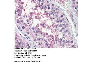 Immunohistochemistry with Human Testis lysate tissue at an antibody concentration of 5. (TRIM8 抗体  (N-Term))
