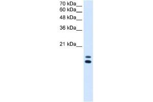 UXT antibody used at 2. (UXT 抗体  (N-Term))