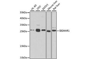 Western blot analysis of extracts of various cell lines, using SIGMAR1 antibody. (SIGMAR1 抗体)