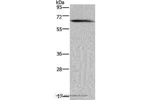 Western blot analysis of Human brain malignant glioma tissue, using NCF2 Polyclonal Antibody at dilution of 1:200 (NCF2 抗体)