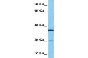 Western Blotting (WB) image for anti-Zinc Finger Protein 36, C3H Type, Homolog (Mouse) (ZFP36) (N-Term) antibody (ABIN2775764)