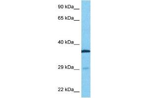 Host:  Rabbit  Target Name:  TTP  Sample Type:  Fetal Lung lysates  Antibody Dilution:  0. (ZFP36 抗体  (N-Term))