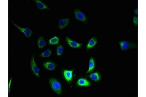 Immunofluorescent analysis of A549 cells using ABIN7160449 at dilution of 1:100 and Alexa Fluor 488-congugated AffiniPure Goat Anti-Rabbit IgG(H+L) (FAM168B 抗体  (AA 43-100))