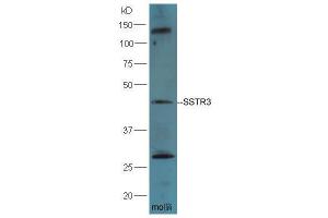 Mouse Brain lysates probed with Rabbit Anti-SSTR3 Polyclonal Antibody, Unconjugated  at 1: 5000 for 90min at 37˚C. (SSTR3 抗体)