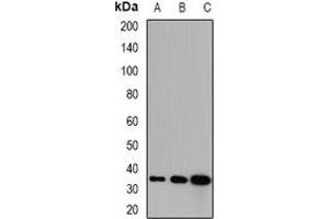 Western blot analysis of GPD1 expression in mouse kidney (A), mouse skeletal muscle (B), rat liver (C) whole cell lysates. (GPD1 抗体)
