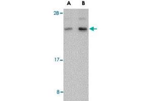 Western blot analysis of BANF1 in human kidney tissue lysate with BANF1 polyclonal antibody  at (A) 0. (BANF1 抗体  (C-Term))