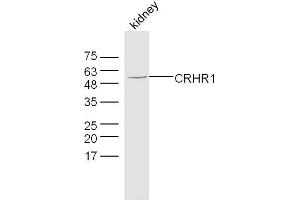 Mouse kidney lysates probed with CRHR1 Polyclonal Antibody, Unconjugated  at 1:300 dilution and 4˚C overnight incubation. (CRHR1 抗体  (AA 55-150))