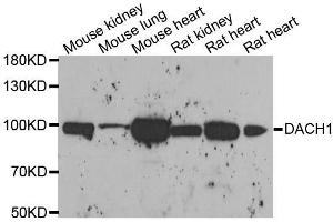 Western blot analysis of extracts of various cell lines, using DACH1 antibody.