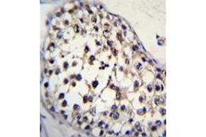 Immunohistochemistry (Paraffin-embedded Sections) (IHC (p)) image for anti-Fucosyltransferase 8 (Alpha (1,6) Fucosyltransferase) (FUT8) (AA 336-364), (Middle Region) antibody (ABIN952402)