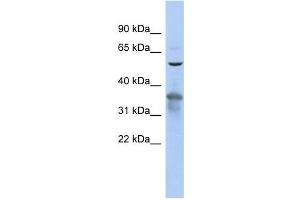 RAB3IP antibody used at 1 ug/ml to detect target protein. (RAB3IP 抗体)