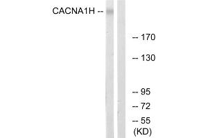 Western blot analysis of extracts from A549 cells, using CACNA1H antibody. (CACNA1H 抗体  (Internal Region))