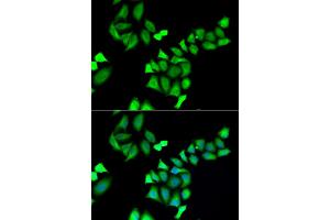Immunofluorescence analysis of A549 cells using GALE antibody (ABIN5973962). (GALE 抗体)