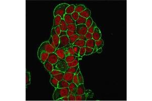 Immunofluorescence Analysis of PFA-fixed MCF-7 cells. (CD47 抗体)