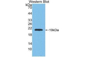 Western Blotting (WB) image for anti-Matrix Metallopeptidase 9 (Gelatinase B, 92kDa Gelatinase, 92kDa Type IV Collagenase) (MMP9) (AA 226-391) antibody (ABIN1078311) (MMP 9 抗体  (AA 226-391))