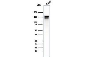 Western Blot Analysis of A431 cell lysate using EGFR Mouse Monoclonal Antibody (GFR/1667).