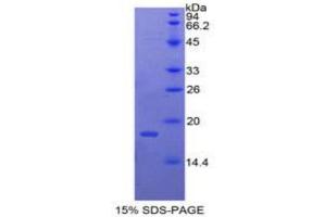 SDS-PAGE analysis of Chicken BMP4 Protein. (BMP4 蛋白)