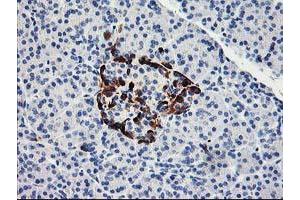 Immunohistochemical staining of paraffin-embedded Human pancreas tissue using anti-ACSS2 mouse monoclonal antibody.