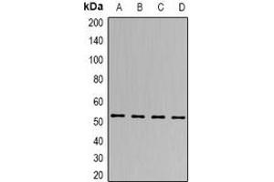 Western blot analysis of SEN2 expression in Hela (A), A549 (B), mouse brain (C), rat heart (D) whole cell lysates. (TSEN2 抗体)