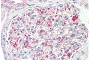 Image no. 3 for anti-STE20-Like Kinase (SLK) (AA 1151-1200) antibody (ABIN2879164) (SLK 抗体  (AA 1151-1200))