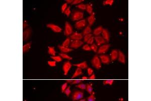 Immunofluorescence analysis of U2OS cells using TMOD4 Polyclonal Antibody (Tropomodulin 4 抗体)