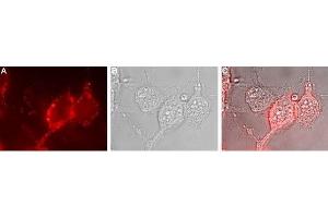 Immunocytochemistry (ICC) image for anti-Solute Carrier Family 12 (Potassium-Chloride Transporter) Member 2 (SLC12A2) (AA 828-841), (Intracellular) antibody (ABIN7043671)