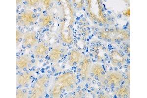 Immunohistochemistry of paraffin-embedded Mouse kidney using CYP4A11 Polyclonal Antibody at dilution of 1:100 (40x lens). (CYP4A11 抗体)