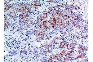 Immunohistochemistry (IHC) image for anti-pan Keratin (panKRT) (pan) antibody (ABIN3187842)