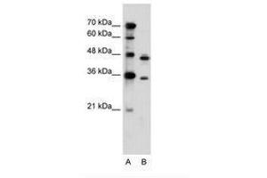 Image no. 2 for anti-phosphoribosyl Pyrophosphate Synthetase 2 (PRPS2) (AA 168-217) antibody (ABIN6736614) (PRPS2 抗体  (AA 168-217))