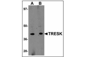 Western blot analysis of TRESK in rat brain tissue lysate with TRESK antibody at (A) 1 and (B) 2 µg/ml.