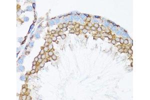 Immunohistochemistry of paraffin-embedded Mouse testis using CTNNA1 Polyclonal Antibody at dilution of 1:100 (40x lens). (CTNNA1 抗体)