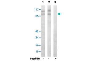 Western blot analysis of extracts from HepG2 cells (Lane 1) and HUVEC cells (Lane 2 and lane 3), using CDK11B polyclonal antibody . (CDK11 抗体  (N-Term))
