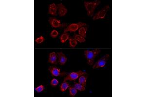 Immunofluorescence analysis of HeLa cells using CSF2RA antibody (ABIN3017509, ABIN3017510, ABIN3017511 and ABIN6220125) at dilution of 1:100 (40x lens). (CSF2RA 抗体  (AA 23-150))