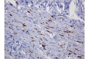 Immunohistochemistry (IHC) image for anti-Sterol O-Acyltransferase 2 (SOAT2) (AA 1-120) antibody (ABIN2715639) (SOAT2 抗体  (AA 1-120))