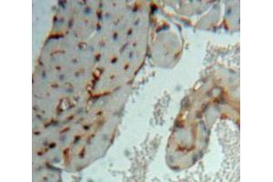 Used in DAB staining on fromalin fixed paraffin-embedded Heart tissue (MAPKAP Kinase 3 抗体  (AA 129-329))