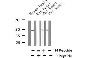 Western blot analysis of Phospho-HDAC8 (Ser39) expression in various lysates (HDAC8 抗体  (pSer39))