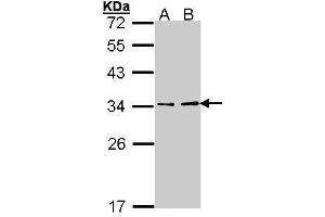 WB Image Sample (30 ug of whole cell lysate) A: Hep G2 , B: Molt-4 , 12% SDS PAGE antibody diluted at 1:1000 (ATP6V1E1 抗体  (Center))