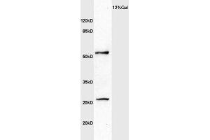 Human colon carcinoma lysate probed with Anti MMP1 Polyclonal Antibody, Unconjugated  at 1:3000 for 90 min at 37˚C.
