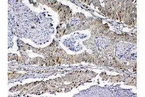 IHC analysis of MED9 using anti-MED9 antibody . (MED9 抗体  (AA 55-146))