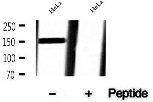 anti-Splicing Factor 3b, Subunit 1, 155kDa (SF3B1) (pThr313) antibody
