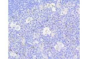 Immunohistochemistry of paraffin-embedded human tonsil using CASP3 antibody (ABIN4903137) at dilution of 1:100 (40x lens). (Caspase 3 抗体)