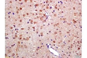Formalin-fixed and paraffin embedded rat brain labeled with Anti-TNIP2 Polyclonal Antibody, Unconjugated (ABIN872901) at 1:200 followed by conjugation to the secondary antibody and DAB staining (TNIP2 抗体  (AA 85-180))
