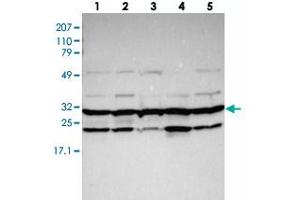 Western blot analysis of Lane 1: RT-4, Lane 2: EFO-21, Lane 3: U-138 MG, Lane 4: Liver, Lane 5: Tonsil with PSMA3 polyclonal antibody . (PSMA3 抗体)