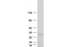 Western Blotting (WB) image for StAR-Related Lipid Transfer (START) Domain Containing 4 (STARD4) protein (Myc-DYKDDDDK Tag) (ABIN2732765)