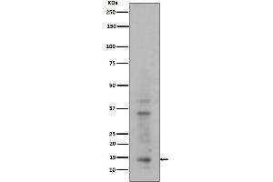 Western blot analysis of Histone H3 (mono+di+tri methyl K14) expression in HeLa cell lysate.