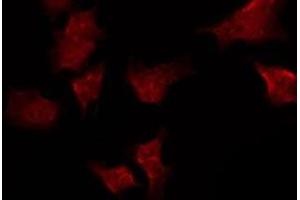 ABIN6275478 staining Hela by IF/ICC. (RGS10 抗体  (Internal Region))