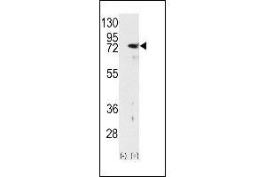 Western blot analysis of PKC delta (arrow) using rabbit polyclonal PKC delta Antibody (N-term) (ABIN391006 and ABIN2841179). (PKC delta 抗体  (N-Term))