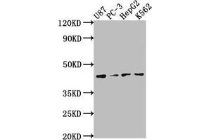 Western Blot Positive WB detected in: U87 whole cell lysate, PC-3 whole cell lysate, HepG2 whole cell lysate, K562 whole cell lysate All lanes: OPCML antibody at 1:2000 Secondary Goat polyclonal to rabbit IgG at 1/50000 dilution Predicted band size: 39, 38, 34 kDa Observed band size: 39 kDa (OPCML 抗体  (AA 28-322))