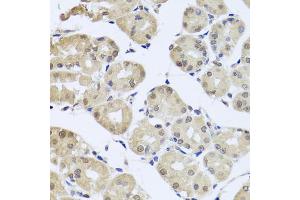 Immunohistochemistry of paraffin-embedded human stomach using cdc45 antibody (ABIN5971079) at dilution of 1/100 (40x lens). (CDC45 抗体)