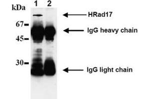 Western Blotting (WB) image for anti-RAD17 (RAD17) antibody (ABIN492574) (RAD17 抗体)